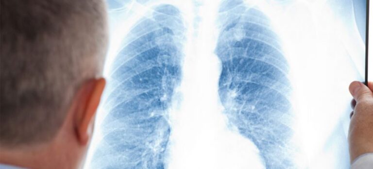 Световната здравна организация ( СЗО ) наблюдава огнище на мистериозна пневмония